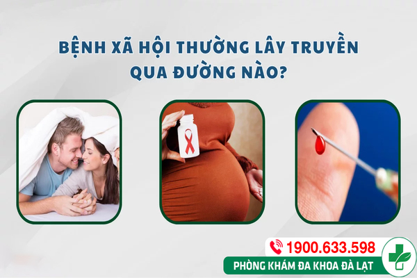 Hình ảnh minh họa